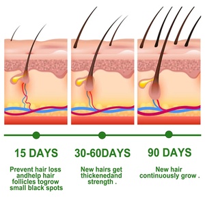 Rosemary Hair Oil Deeply Nourishing the <b>Scalp</b> and Repairing Hair Follicles Hair Growth Essential Oil - Product Image 5