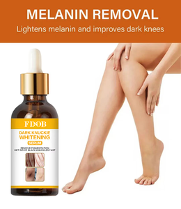 Suero Vegano para Manos, Codos y Rodillas, Eliminador <span class=keywords><strong>de</strong></span> <span class=keywords><strong>Manchas</strong></span> Intensas, <span class=keywords><strong>Corrector</strong></span> <span class=keywords><strong>de</strong></span> Pigmentación, Antiarrugas y Blanqueador para Piel Negra - Product Image 3