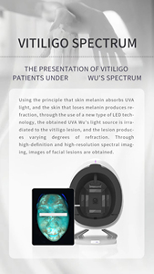 Analizador digital Máquina de análisis facial Máquina de análisis de piel Tratamiento de belleza profesional - Product Image 6