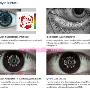 เครื่องวิเคราะห์การวินิจฉัยโรคตาแห้งแบบไม่รุกล้ำและไม่สัมผัส DEA60 คุณภาพดีที่สุด - Product Image 6