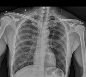 원텍 X60 휴대용 DR 시스템, 선명한 영상 제공을 위한 병원용 DR 장비 가격, 휴대용 이동식 디지털 방사선 촬영기 - Product Image 2