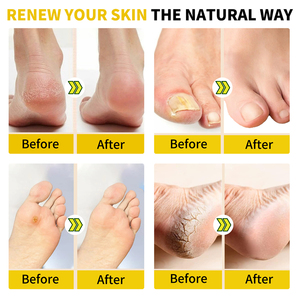 SEFUDUN 10 pièces Sachets de bain de pieds détoxifiants et apaisants aux herbes pour le corps, amincissants, réducteurs de fatigue - Product Image 5