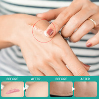 Crème cicatrisante à base de plantes Sumifun pour les cicatrices corporelles et l'élimination des marques 10 ml