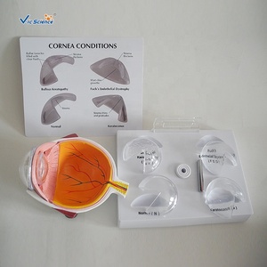 Kératopathie modèle d'éducation des sciences médicales pour la formation organologie modèle oculaire de maladie cornéenne humaine - Product Image 4