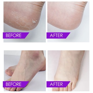 Vente flash : Sel de bain pour les pieds fait <span class=keywords><strong>maison</strong></span>, gelée de cristal à la lavande, poudre de sel, adoucit et blanchit les pieds, cristaux de bain pour les pieds DIY - Product Image 3