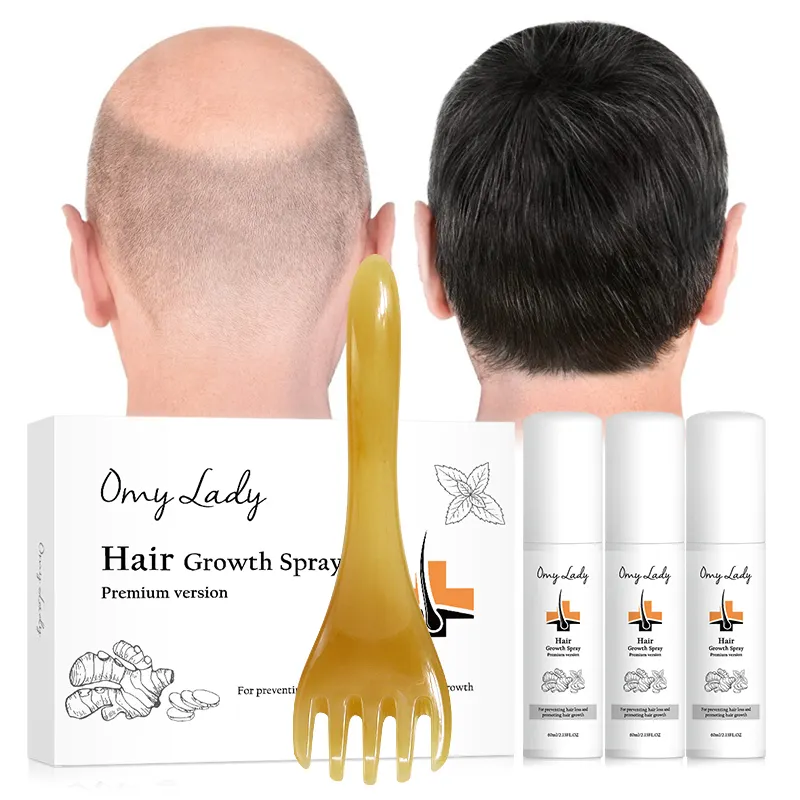 Free Sample Private Label Hair Growth Spray Bald Hair Care Regrowth Anti Hair Loss Oil