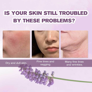 Suero hidratante para el cuidado de la piel de marca privada, antiarrugas, con productos de belleza personalizables, crema facial - Product Image 6