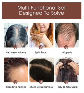 <span class=keywords><strong>Bio</strong></span> Organic Biotin Haarpflege set Private Label Verdickung wachstum Anti-Loss Shampoo Conditioner mit Salicylsäure Pfefferminze - Product Image 5