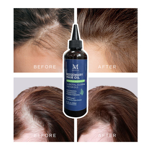 Großhandel 200ml Haarwuchsöl zur Kopfhautreinigung und Haarstärkung mit Rosmarin und Kräutern für Tägliches Haarwachstum - Product Image 1