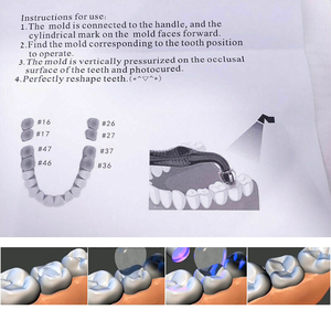 Kit di Stampi Estetici per Denti Posteriori Orthdent, Strumenti per Restauro Perfetto e Riempimento Dentale, Terapia Orale, 1 Set - Product Image 6