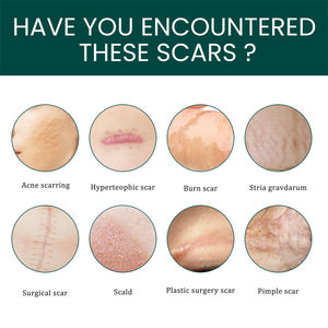 EELHOE lembaran bekas luka silikon pelembut penghilang kemerahan hiperteofik membakar Stria Gravdarum perawatan luka lembar silikon bekas luka - Product Image 4