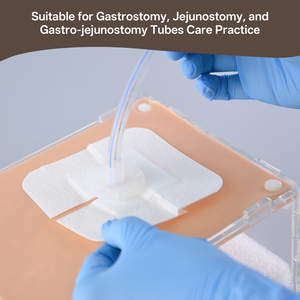 Modèle de gastrostomie et d'alimentation par sonde, simulation réaliste de <span class=keywords><strong>procédure</strong></span> PEG pour la formation médicale et infirmière - Product Image 5