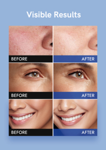 OEM ODM Venta al por mayor Piel muerta Eliminación Suave Piel delicada Obtener Gel exfoliante Gel orgánico <span class=keywords><strong>Peeling</strong></span> - Product Image 5
