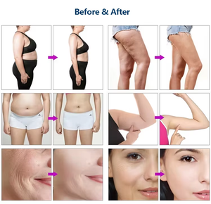 Xách tay nhà Spa 30k đốt cháy chất béo cơ thể Massager chống cellulite Massager cơ thể Máy giảm béo - Product Image 6