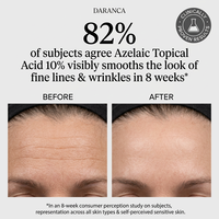 Soin de la peau du visage coréen personnalisé OEM ODM, marque privée, sérum pour le visage anti-acné de qualité supérieure à l'acide salicylique et à l'acide azélaïque à 10 %