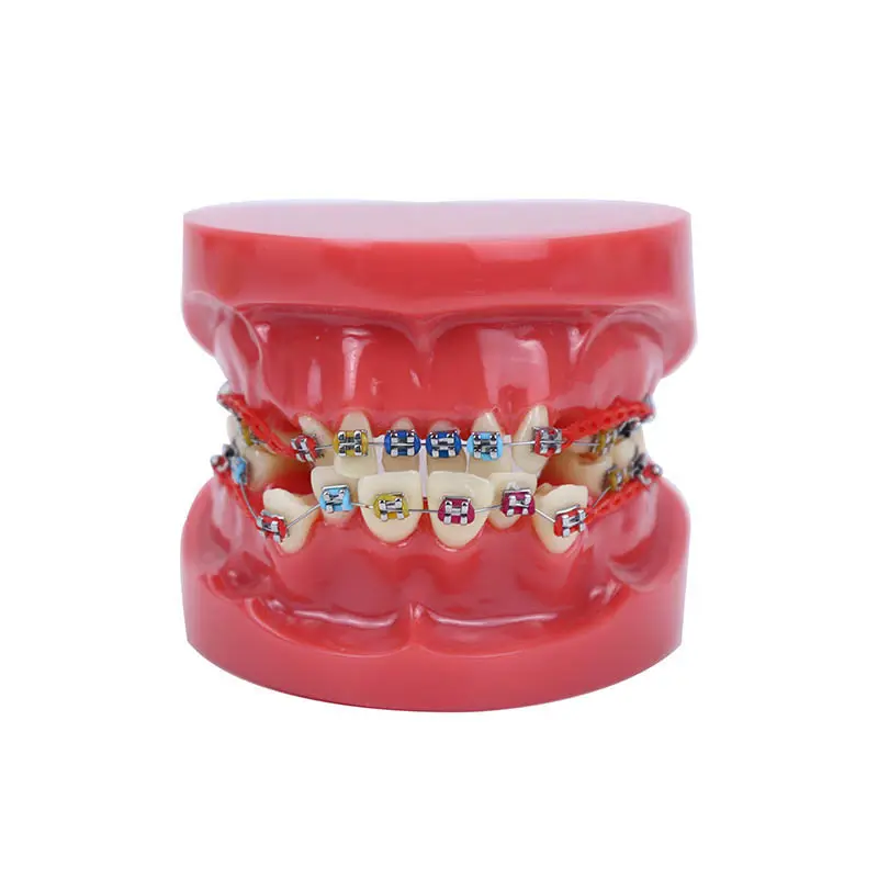 Dental Typodont With Mental Braces Orthodontic Teeth Study Model For Trainning With Ligature Ties Clear
