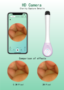 WIFI USB endoskopi vagina 2MP kamera serviks - Product Image 4