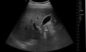 Wifi xách tay 128 yếu tố Mano không dây DOPPLER máy tính xách tay siêu âm đầu dò - Product Image 3