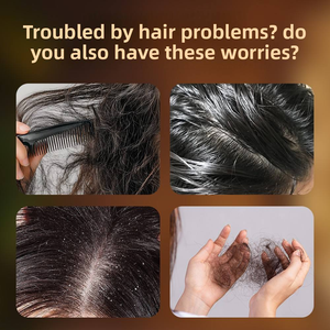 صابون صمت نبات الشامبو للشعر الجاف والتالف يعزز شريط صبغ من أجل النمو - Product Image 4