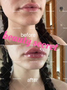 Vente en gros, pur végétalien, réduit les ridules, améliore l'éclat, hydrate, augmente le volume des lèvres, huile repulpante - Product Image 5