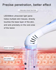 Fototerapia Casera Kernel KN-4003B1 308nm, Fototerapia UVB Portátil para el Tratamiento del Vitiligo, Lesiones Alrededor de <span class=keywords><strong>los</strong></span> <span class=keywords><strong>Ojos</strong></span> y la Frente - Product Image 3