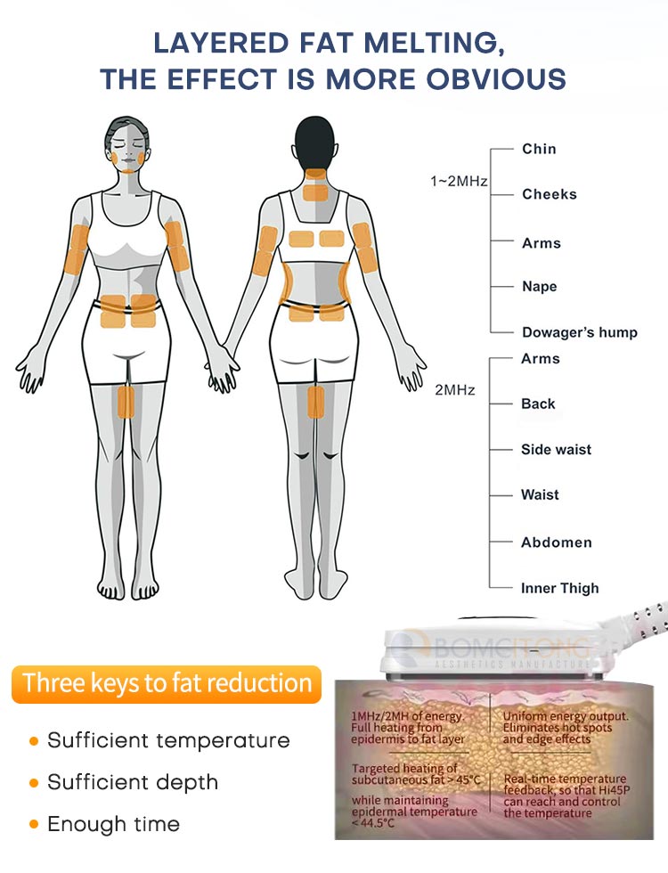 Non Surgical Professional Body Contouring Machine for Sale
