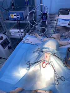 <span class=keywords><strong>Monitor</strong></span> de Sinais Vitais Portátil Mini com Sensor de Oximetria SpO2 e Manguito NIBP, Módulo Médico OEM - Product Image 6