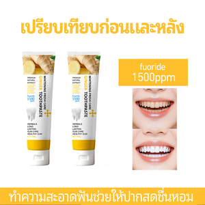 Dentifrice au gingembre en gros, 1500ppm de fluorure, pour la <span class=keywords><strong>protection</strong></span> contre les caries, blanchissant aux herbes, élimine les taches, soin des gencives et de la bouche - Product Image 3