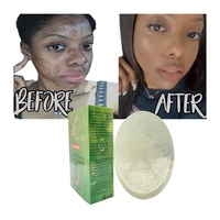 Savon éclaircissant pour l'acné et les taches noires de marque privée Traitement efficace de la pigmentation de la peau éclaircissant le teint uniforme