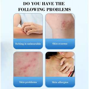 ครีมกลากสำหรับผิวแก้คันสิวครีมกลากติดเชื้อราสำหรับผิวสมุนไพรออกแบบได้ตามต้องการ - Product Image 6