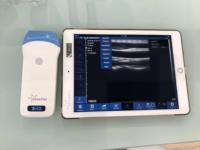Appareil d'échographie vétérinaire intelligent sans fil avec sonde intégrée pour le diagnostic de gestation des porcs, bovins, ovins, caprins - Équipement agricole