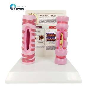 Modèle de comparaison de la trachée humaine saine et de la trachée asthmique |   <span class=keywords><strong>Aide</strong></span> pédagogique anatomique médicale pour l'éducation du système <span class=keywords><strong>respiratoire</strong></span> - Product Image 1