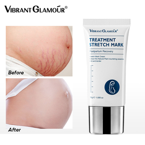 VIBRANT GLAMOUR-Crema corporal para eliminar cicatrices de <span class=keywords><strong>embarazo</strong></span>, tratamiento de marcas elásticas - Product Image 2