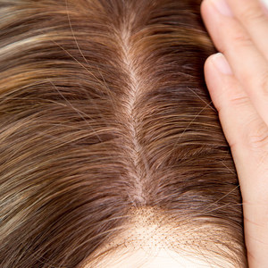 Parrucca Medica Personalizzata di Alta Qualità con Base in Seta 5*5, <span class=keywords><strong>Capelli</strong></span> Naturali Russi Vergini, Colore <span class=keywords><strong>Castano</strong></span> con Riflessi, per Donne - Product Image 6