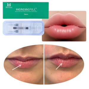 Relleno Dérmico Inyectable de Alta Calidad con Certificación CE, 2 ml, Relleno de Ácido Hialurónico para <span class=keywords><strong>Labios</strong></span> - Product Image 1