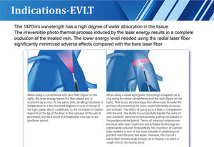 Láser de Fibra EVLT Portátil de Escritorio, Gran Venta, 1470nm 1940nm, Láser Diodo Endovenoso para Eliminación de Arañas Vasculares y Venas Varicosas - Product Image 5