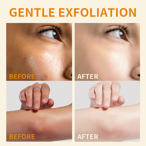 Lot de <span class=keywords><strong>2</strong></span> en 1 : Nettoyant Exfoliant Visage et Corps Éclaircissant à l'Acide Kojique et Curcumine avec PHA BHA LHA 280ml - Product Image 5