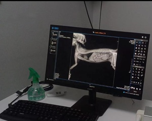 Bras rotatif DR AI capable d'imagerie en position verticale, haute définition, capable d'assister dans les interventions chirurgicales, approuvé CE - Product Image 3