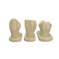 Modelos Dentales y de Guía para Tallado de Dientes