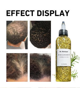 ビーガン育毛サプリメント120mlローズマリーベストナチュラルオーガニック高速育毛オイル黒人女性用 - Product Image 6