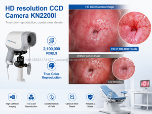 Colposcope vidéo numérique CE ISO certifié, 2,1 MP, 1080P, avec base de données patient, filtre vert 4 niveaux, logiciel puissant KN-2200I - Product Image 4