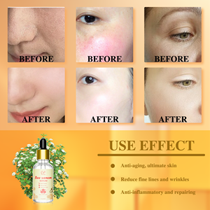 Suero Facial Antienvejecimiento de <span class=keywords><strong>Triple</strong></span> Acción con Péptidos Múltiples, Ácido Hialurónico, Hidratante, Reparador de Arrugas y Veneno de Abeja, Marca Privada - Product Image 3