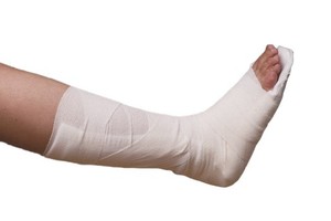 Ortopédico Profesional Nuevo Diseño Fabricante Precio Proveedor Médico Post Op Cómodo Poliéster Algodón Férula para Fractura - Product Image 2