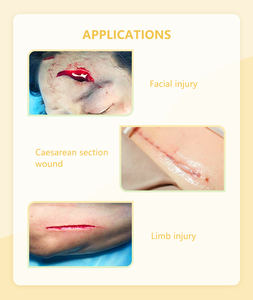 BLU ENJOY Notfall Nahtlose Pu Verschluss streifen Band Wund verband Gips Reiß verschluss stich Wund verschluss vorrichtung Reiß verschluss nähte - Product Image 6