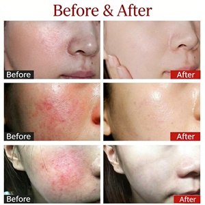 <span class=keywords><strong>Masque</strong></span> facial réparateur de la barrière cutanée de qualité médicale, compresse froide, hémostase rapide, anti-rougeurs, apaisant et calmant pour le visage - Product Image 3