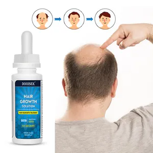 Nhãn hiệu riêng chống rụng tóc mọc lại điều trị dầu phụ nữ tóc tăng trưởng dầu người đàn ông huyết thanh Biotin tăng trưởng tóc huyết thanh