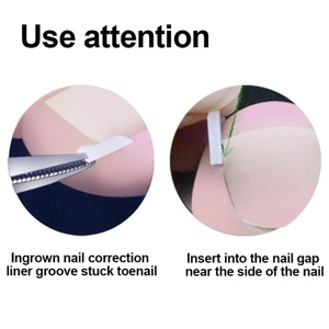 Parches Correctores de Uñas de Alta Calidad OEM al por Mayor, Adhesivos para el Tratamiento de Hongos en las Uñas de los Pies, para la Corrección de Uñas, Set de <span class=keywords><strong>Manicura</strong></span> y Pedicura - Product Image 5
