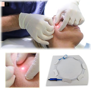 Fibre optique Endolaser 200/400/600/800um SMA905 Chirurgie laser médicale Lipolyse EVLT PLDD Hémorroïdes Fibre courte <span class=keywords><strong>jetable</strong></span> 25cm - Product Image 1
