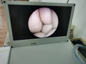 Conjunto de cámara de endoscopia <span class=keywords><strong>integrada</strong></span> médica 4 en 1 para Urología/laparoscopia - Product Image 2