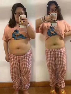 2026 mới nhất giảm cân trẻ hóa da mặt Nâng máy đẹp cho Cellulite - Product Image 2